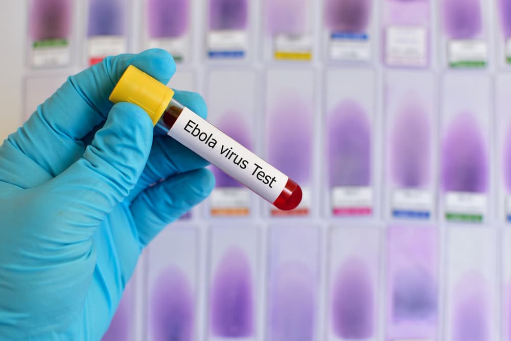 Somalia Releases Ebola Contact After Two Negative Tests